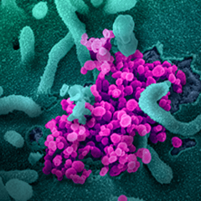 Microscopic view of Novel Coronavirus SARS-CoV-2